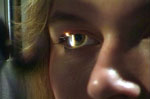 Your doctor will examine your eyes with a magnifying instrument