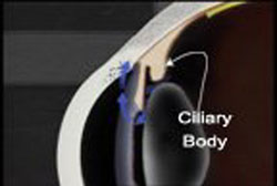 ecpciliarybody_sm