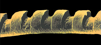 excimer-laser-technology-human-hair