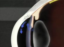 Excess fluid builds pressure