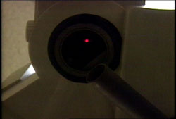 You will be asked to look directly at a target light while the laser reshapes your cornea