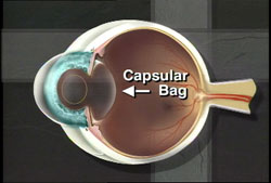 The capsular bag
